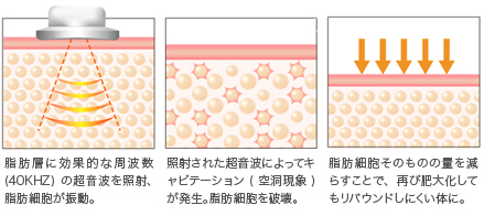 キャビ痩身の仕組み